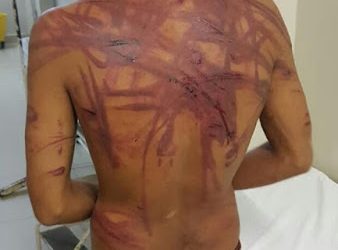 Porto Velho/RO – Em algum lugar do Brasil, homem suspeito de furtar residência é espancado