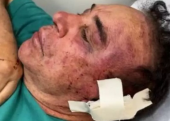 Santa Terezinha/PB – Candidato do Republicanos é espancado na Paraíba e está em estado grave