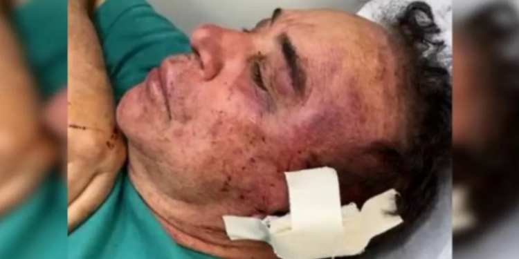 Santa Terezinha/PB – Candidato do Republicanos é espancado na Paraíba e está em estado grave