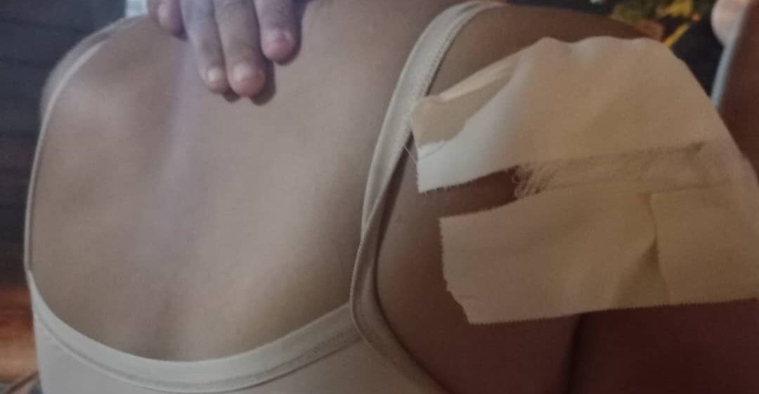 Imperatriz/MA – Mulher sofre tentativa de homicídio no bairro Vila Zenira