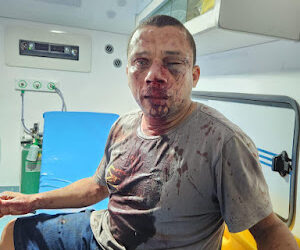 Campestre do Maranhão – Presidente do Sindicato dos Professores, sofre tentativa de homicídio