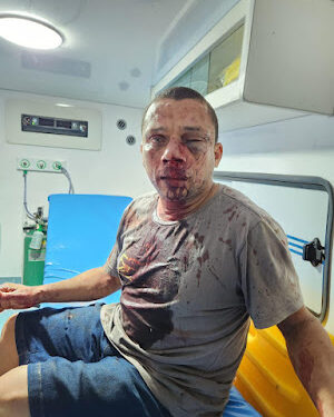 Campestre do Maranhão – Presidente do Sindicato dos Professores, sofre tentativa de homicídio