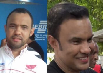 Palmeirândia/MA – Prefeito surge com implante de cabelo e harmonização facial e vídeo viraliza nas redes sociais