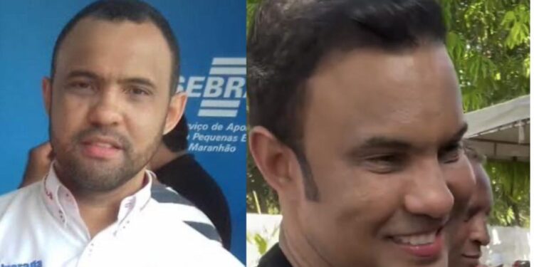 Palmeirândia/MA – Prefeito surge com implante de cabelo e harmonização facial e vídeo viraliza nas redes sociais