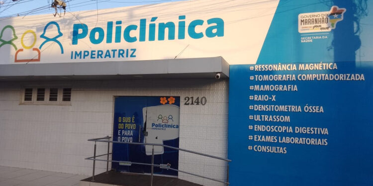 Imperatriz/MA – Governo alcança cerca de 250 mil atendimentos em dois anos da Policlínica