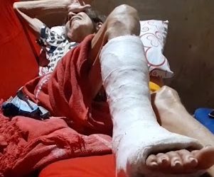 COMOÇÃO! População de Bom Lugar denuncia mais um descaso de Marcos Miranda na saúde